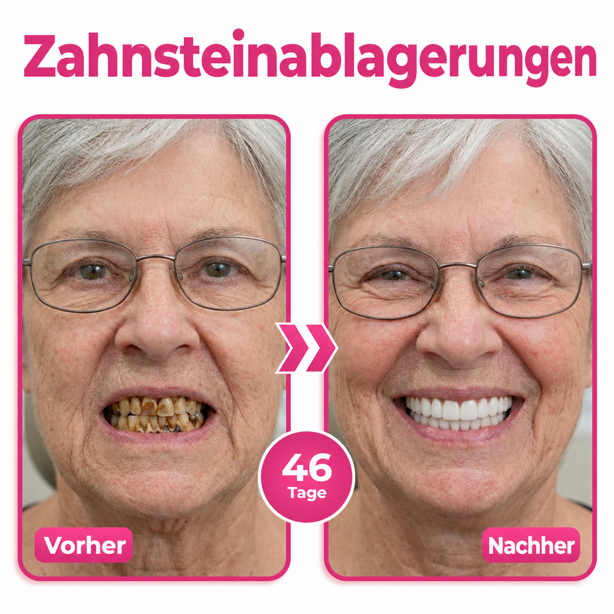 🦷Natravor® Thismile NH-10 Zahnpasta-Serum für Zahnschmelz und Zahnfleisch – Advanced Therapy