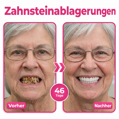 🦷Natravor® Thismile NH-10 Zahnpasta-Serum für Zahnschmelz und Zahnfleisch – Advanced Therapy